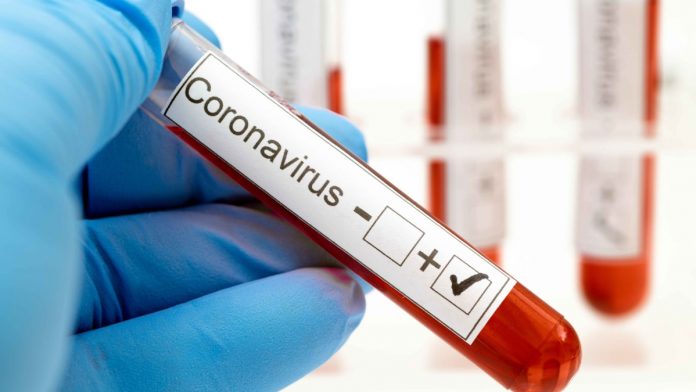 Coronavirus Positivo