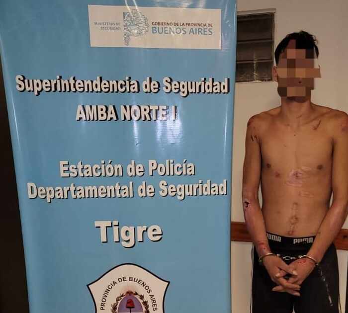 Detienen En San Martín A Un Joven Acusado De Balear A Un Profesor De ...